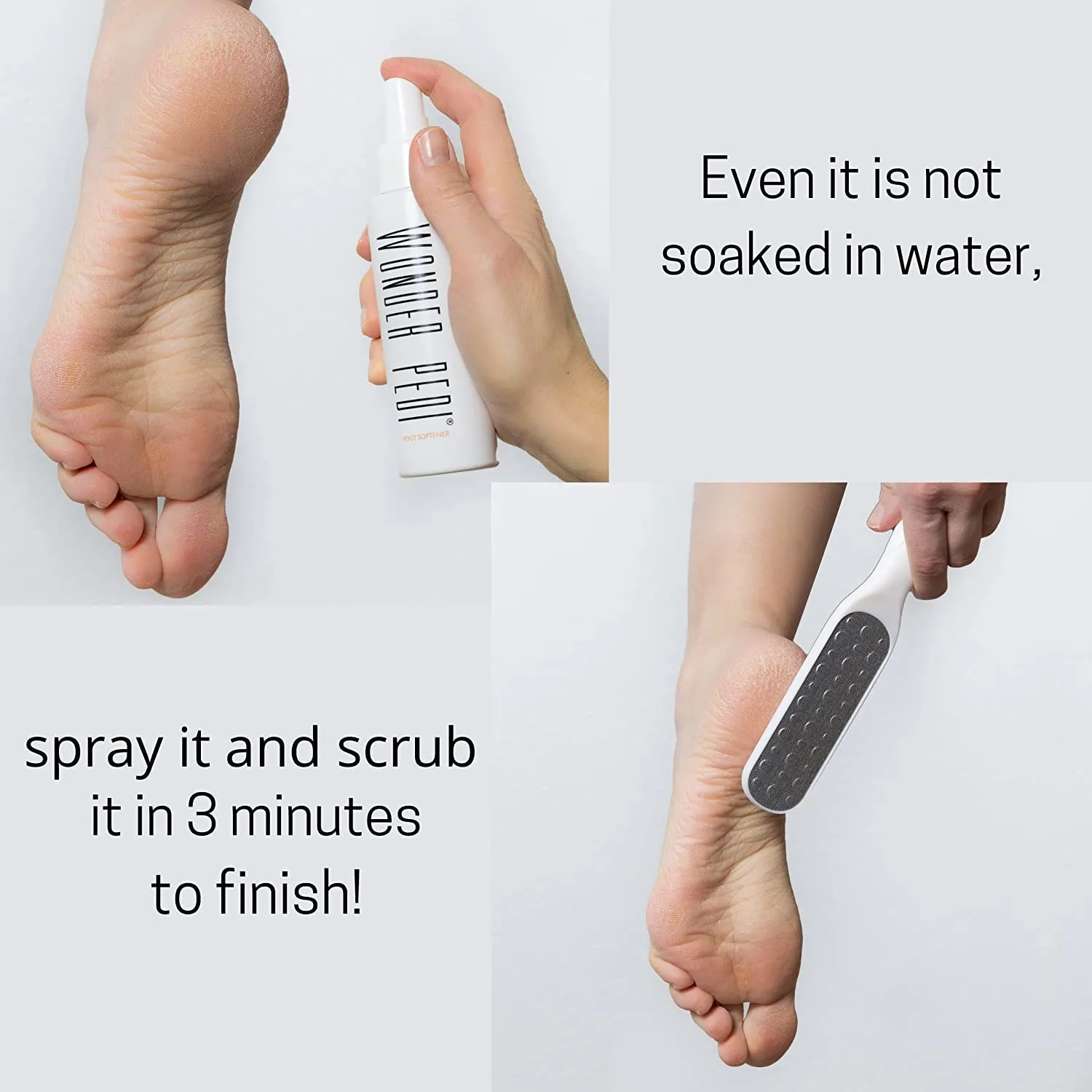 Callus Remover, Instant Exfoliating Foot Peel Spray, Feet Dead Skin Cracked Heels Softener Pedicure Treatment Works with Any Foot File. Wonder Pedi (File   Spray 3.38 FlOz)